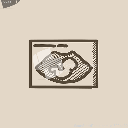 Image of Fetal ultrasound sketch icon.