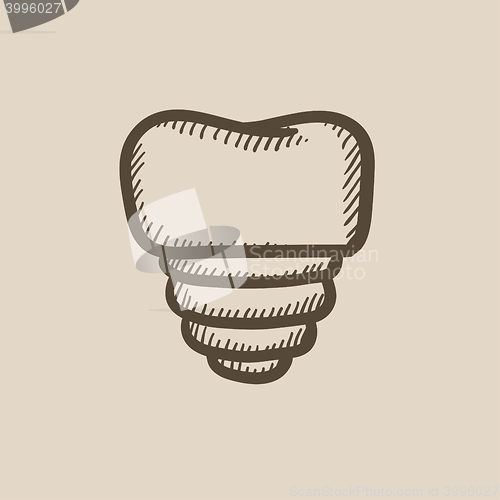 Image of Tooth implant sketch icon.