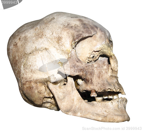 Image of old human skull