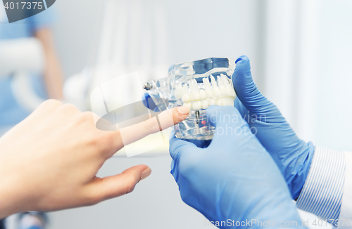 Image of close up of dentist hands with teeth or jaw model