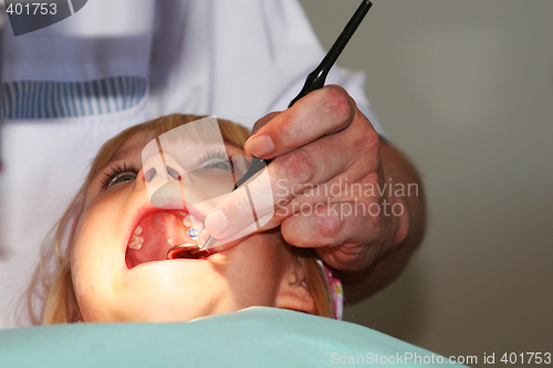 Image of teeth with the blues