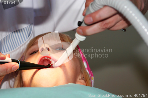 Image of Saliva suction