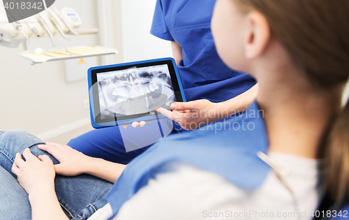 Image of dentist showing x-ray on tablet pc to patient girl