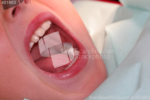 Image of children teeth