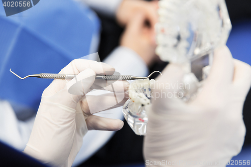 Image of close up of dentist with teeth and dental probe