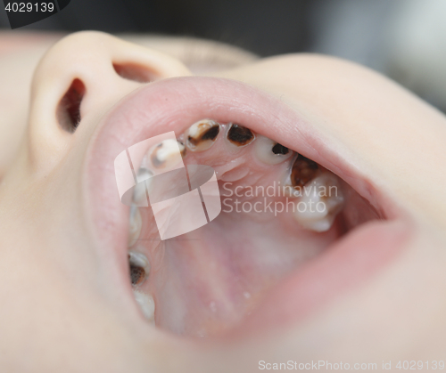 Image of baby open mouth