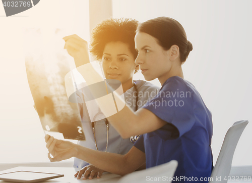 Image of doctors with x-ray image of spine at hospital