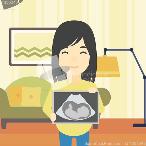 Image of Pregnant woman with ultrasound image.