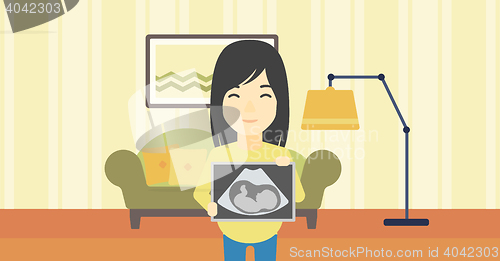 Image of Pregnant woman with ultrasound image.