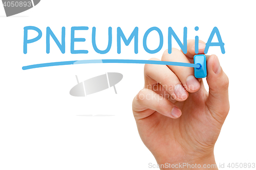 Image of Pneumonia Blue Marker