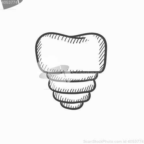 Image of Tooth implant sketch icon.