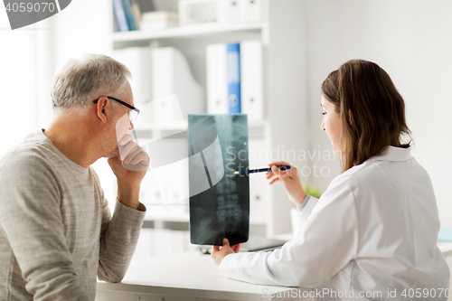 Image of doctor with spine x-ray and senior man at hospital