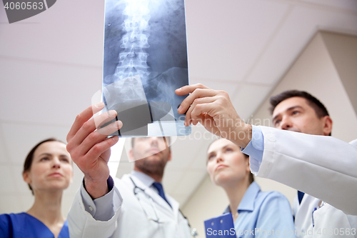 Image of group of medics with spine x-ray scan at hospital