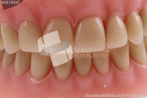 Image of detail plastic teeth