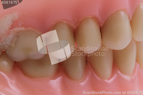 Image of detail plastic teeth