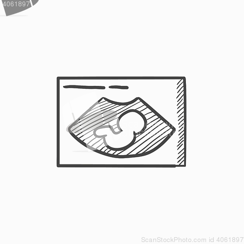 Image of Fetal ultrasound sketch icon.