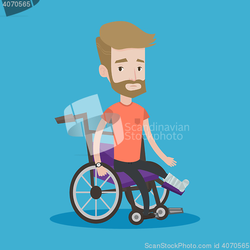 Image of Man with broken leg sitting in wheelchair.