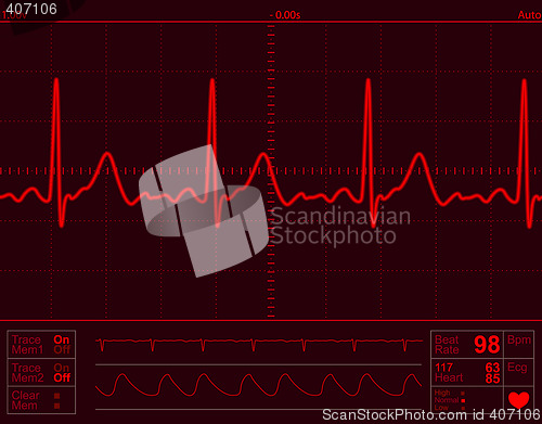 Image of heart monitor screen