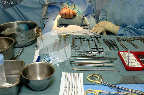 Image of Surgery-Hand Operation