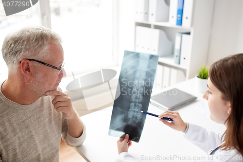 Image of doctor with spine x-ray and senior man at hospital
