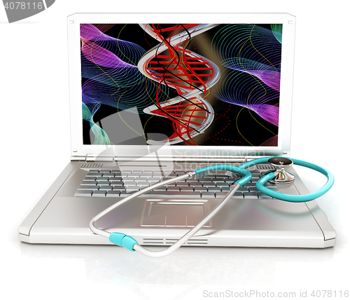 Image of silver laptop diagnosis with stethoscope. 3D illustration