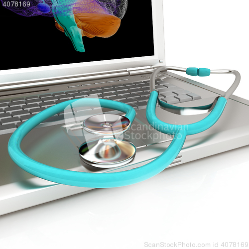 Image of Laptop, brain and Stethoscope. 3d illustration