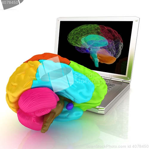 Image of creative three-dimensional model of real human brain and scan on