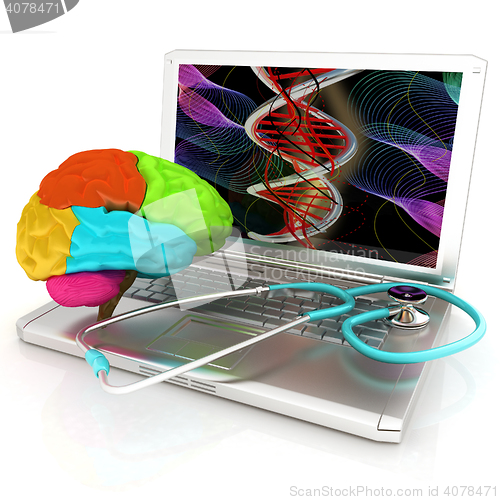 Image of Laptop, brain and Stethoscope. 3d illustration