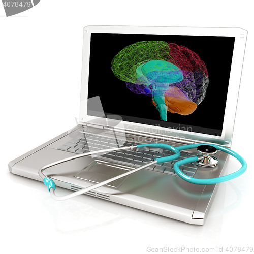 Image of Laptop, brain and Stethoscope. 3d illustration