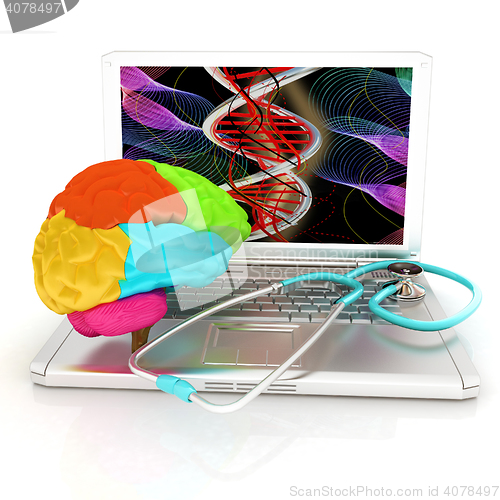 Image of Laptop, brain and Stethoscope. 3d illustration