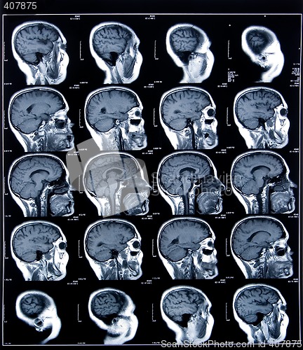 Image of health medical mri