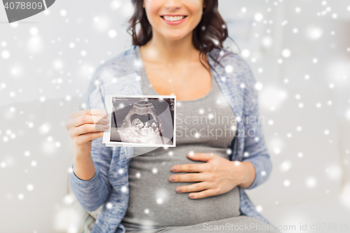 Image of close up of pregnant woman with ultrasound image