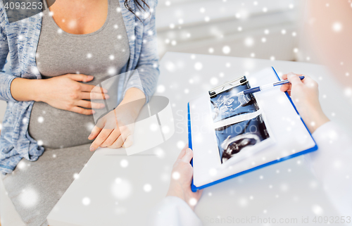 Image of close up of doctor and pregnant woman ultrasound