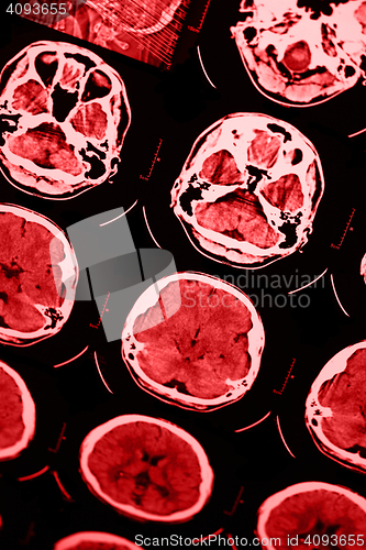 Image of CT and MRI of the skull