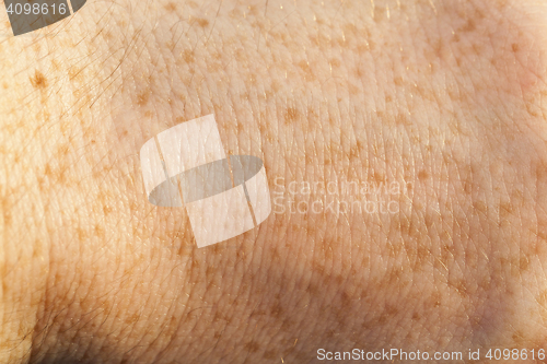 Image of skin of the human hand