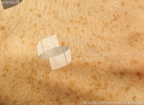 Image of skin of the human hand