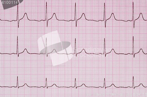 Image of Printed ECG waves