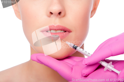 Image of Beauty lip collagen filler injection