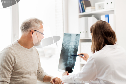 Image of doctor with spine x-ray and senior man at hospital