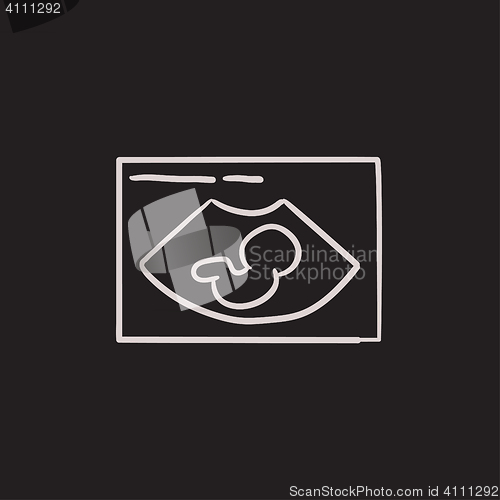 Image of Fetal ultrasound sketch icon.