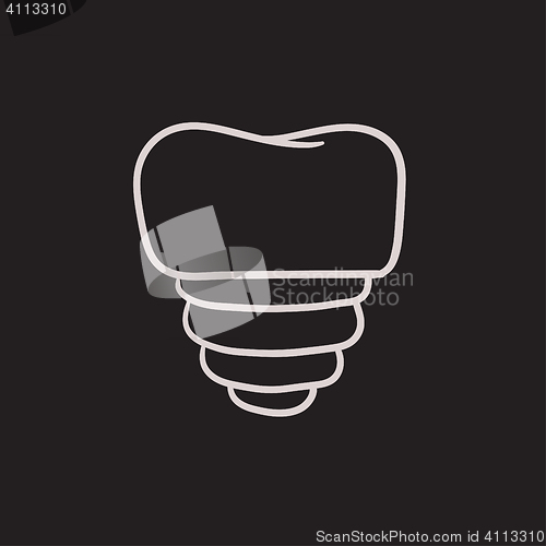 Image of Tooth implant sketch icon.