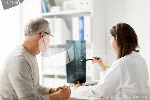 Image of doctor with spine x-ray and senior man at hospital