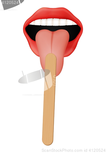 Image of human mouth with wooden tongue depressor