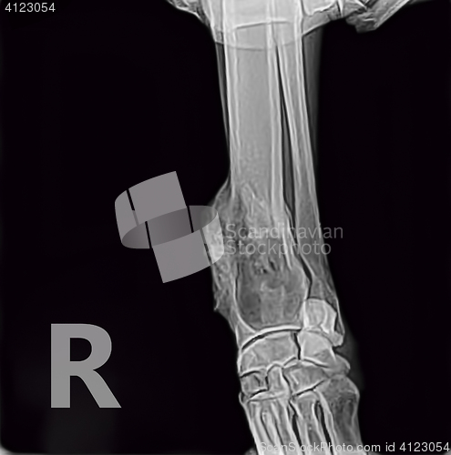 Image of X-ray of osteosarcoma bone tumor foreleg  a dog.