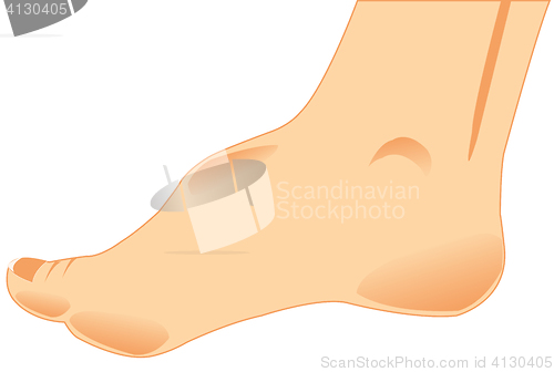 Image of Foot of the person