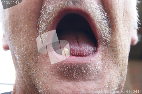 Image of Mouth without teeth