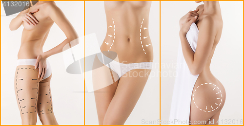 Image of Body correction with the help of plastic surgery on white background