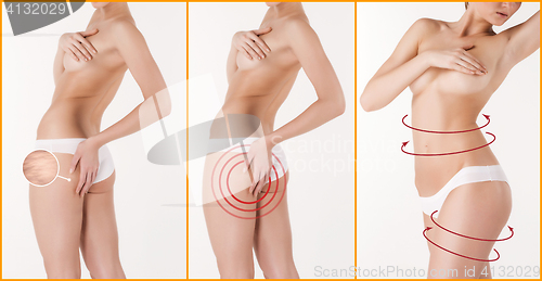 Image of Body correction with the help of plastic surgery on white background