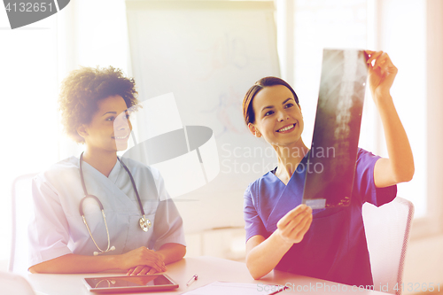 Image of happy female doctors with x-ray image at hospital