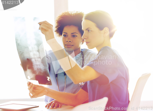 Image of doctors with x-ray image of spine at hospital